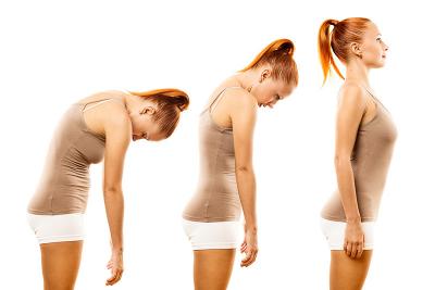 Dorso curvo: cause e sintomatologia, nonché possibili rimedi.