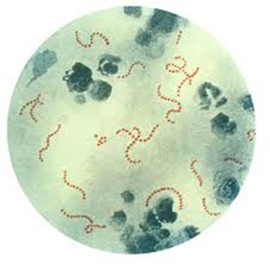 Febbre reumatica: conosci la patologia?