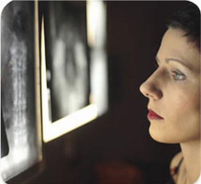 Osteogenesi imperfetta: la patologia, le cause e i trattamenti