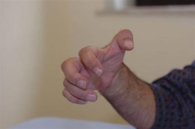 Conosci la sindrome di Volkmann? Consulta l’articolo…