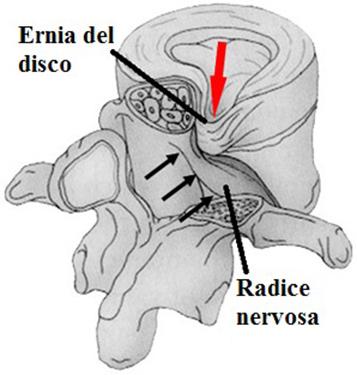 Le vertebre: anatomia, patologie e rimedi antishock