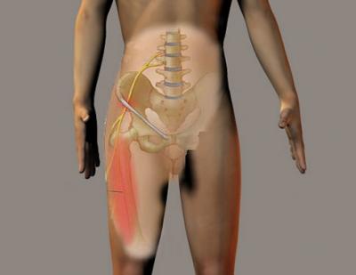 Conosci la meralgia parestesica? Consulta l’articolo…