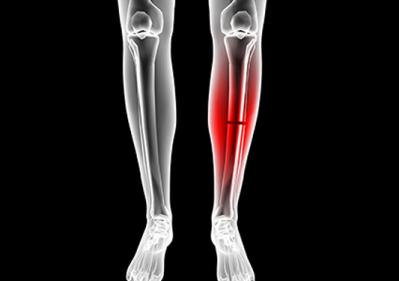 La tibia: anatomia, patologie e rimedi antishock