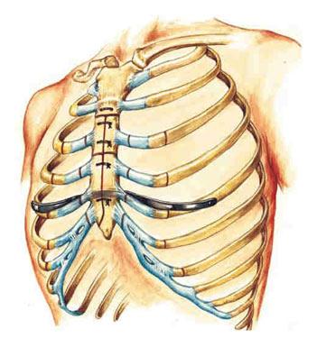 La gabbia toracica: anatomia, patologie e rimedi shock absorbing