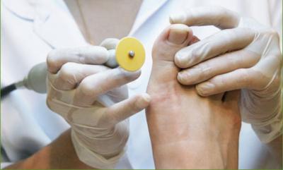 Podologia: di cosa si tratta?