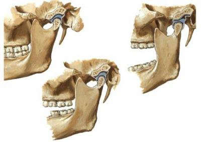 L’articolazione temporo-mandibolare: anatomia, patologie e rimedi shock absorbing