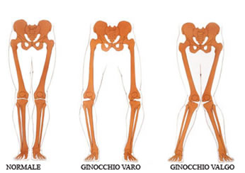 Ginocchio: anatomia, patologie frequenti e possibili rimedi
