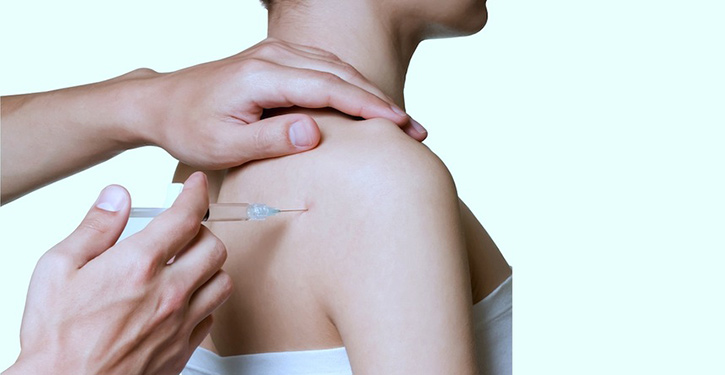 Artrosi acromion claveale: di cosa si tratta?