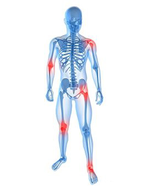 Conosci l’artralgia? Leggi l’articolo...