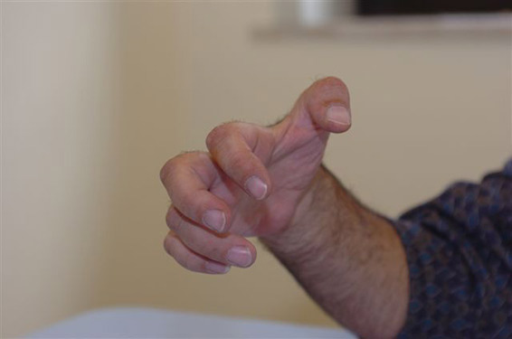 Conosci la sindrome di Volkmann? Consulta l’articolo…