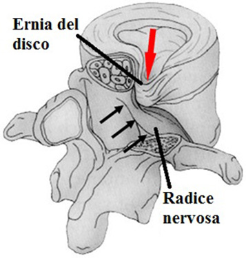 Le vertebre: anatomia, patologie e rimedi antishock