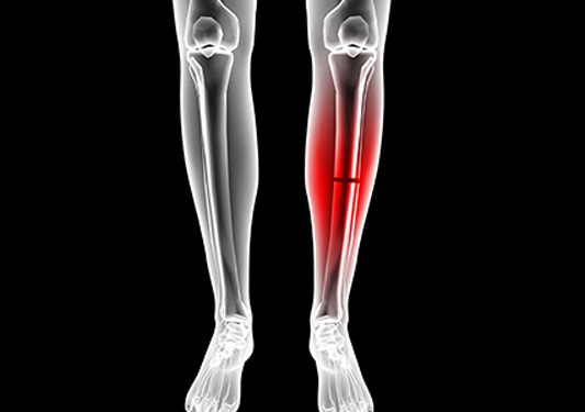 La tibia: anatomia, patologie e rimedi antishock