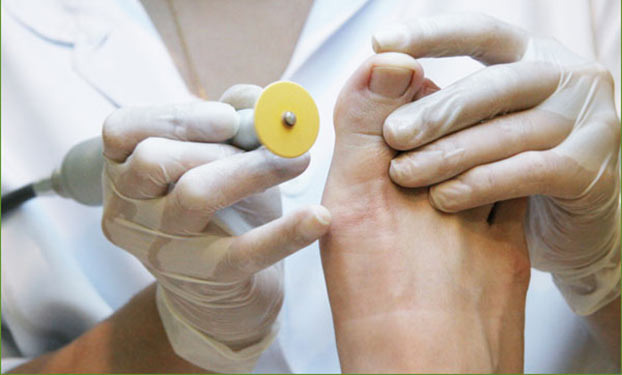 Podologia: di cosa si tratta?