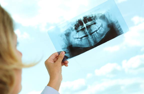Alcuni consigli utili per chi soffre della Sindrome temporo-mandibolare